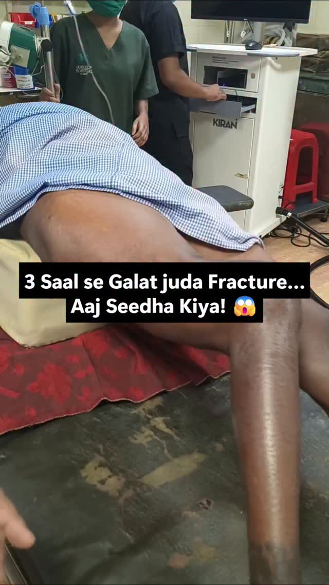 Part 1⚠️3 saal se galat juda fracture...aaj seedha kiya!😱